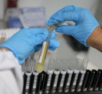 Teste adotado pelo Hemoam permitiu identificar casos de malária em pacientes sem sintomas