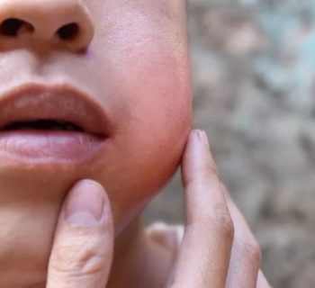 Dor de dente afasta trabalhadores e reduz produtividade no Amazonas